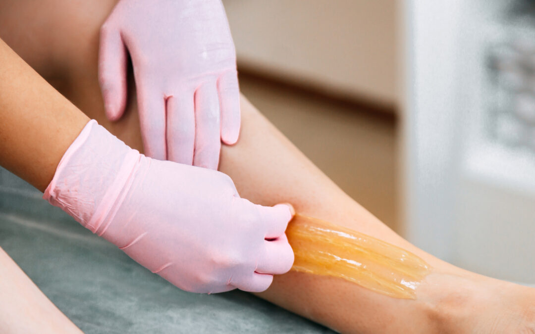 Breaking The Cycle Of Recurring Ingrown Hairs